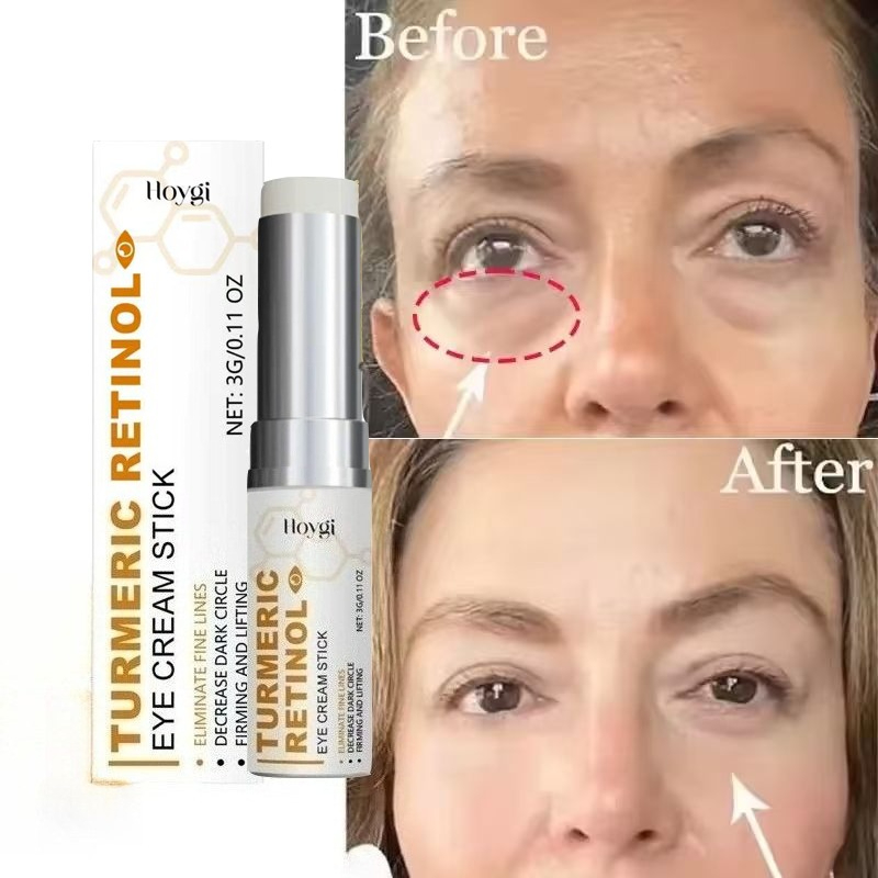 Retinol Anti Wrinkle Cream - Instant Turmeric Eye Bag Removal Cream