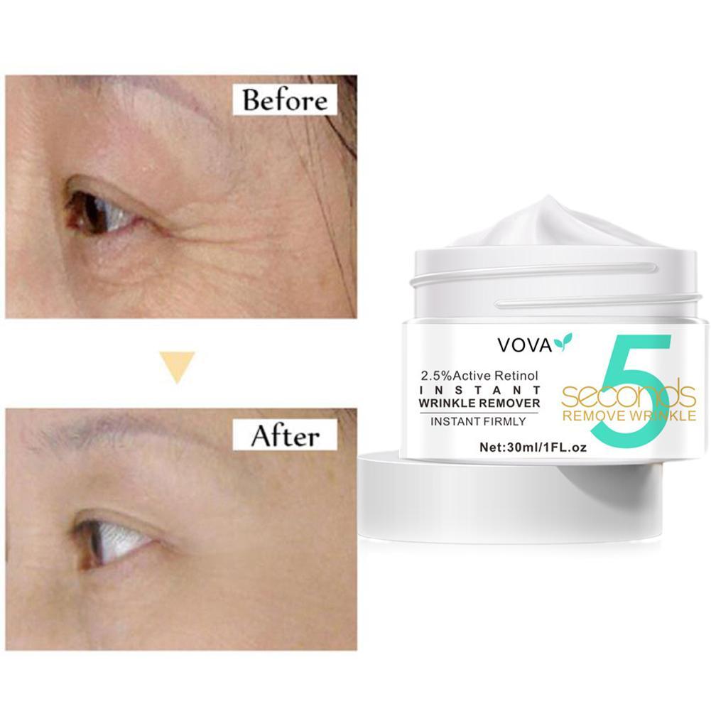 2.5% Active Retinol Eye Cream  - đánh giá và giá Retinol Anti Wrinkle Cream
