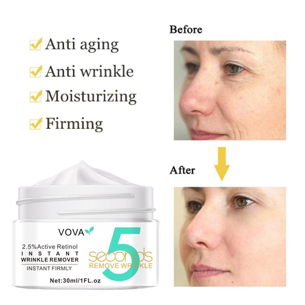 2.5% Active Retinol Eye Cream  - đánh giá và giá Retinol Anti Wrinkle Cream