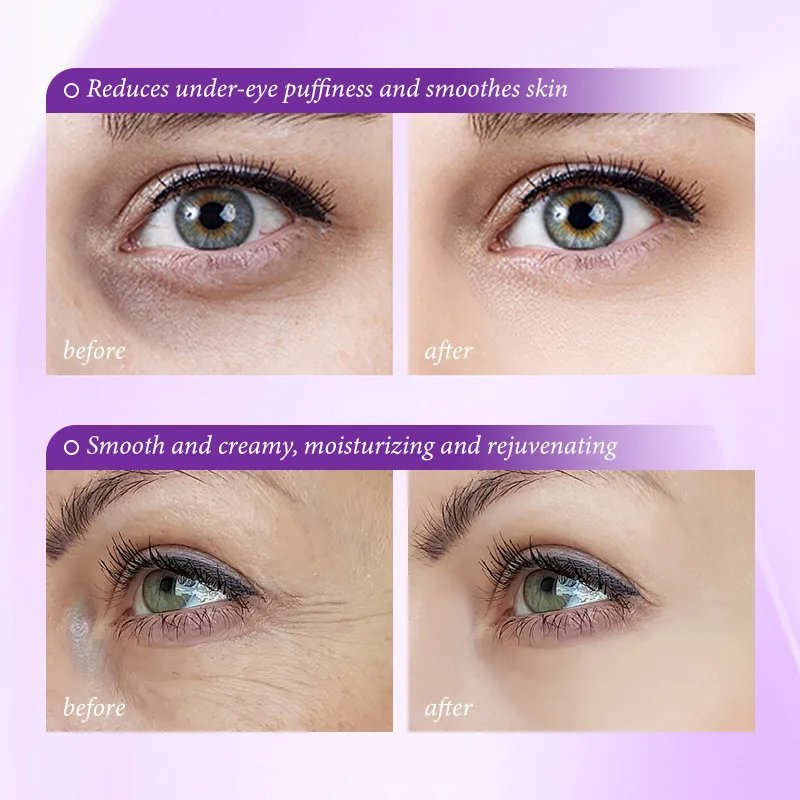 Instant Eye Bag Removal Cream  - đánh giá và giá Retinol Anti Wrinkle Cream